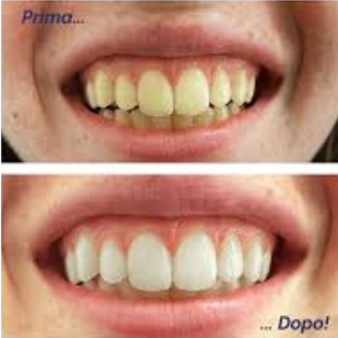 Foto Prima/Dopo Cliente 2
